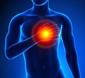 Иногда сердечный приступ скрывается за симптомами изжоги и остеохондроза