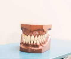 Отбеливание зубов может повредить глубокие слои зубной ткани
